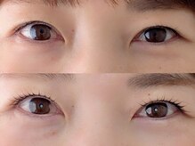 シャール(shall)/まつ毛パーマ/まつげ/マツパ