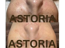 アストリア(ASTORIA)の雰囲気(肌質改善自信あり!!)