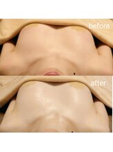 アンドボディ 横浜元町(&Body)/40代後半 &nbsp;左右差改善