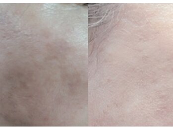 クインティナ(Quintina)/Volayon