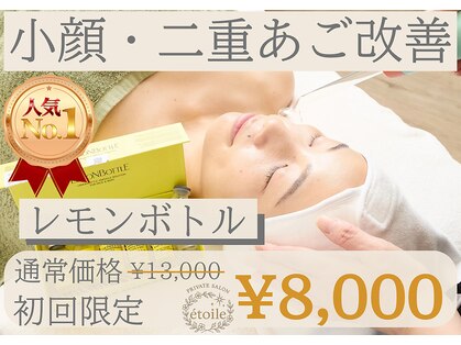 エトワール(etoile)の写真