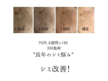 リセット 本山(Reset)の写真