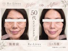 リライブ 亀有店(Re:Lives)の雰囲気（50代からの本格エイジングケア！1ヶ月でこの変化を実感☆）
