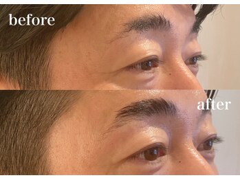 モテテ(motete)/お客様施術例☆栄本店