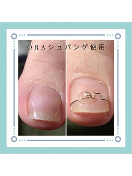 ニコ(niko)の写真/国家資格者によるお客様に寄り添ったカウンセリングで爪のお悩み解消に導きます◎