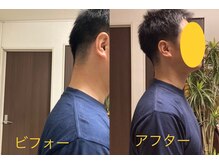 康整体院/首、後ろに下げたい