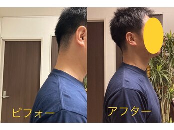 康整体院/首、後ろに下げたい