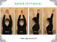 ボディ リセット アンド デザイン(Body Reset & Design)/【施術例】ビフォーアフター