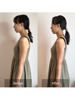 トータルボディケアサロン松濤/ビフォーアフター