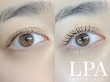 レピア 仙台店/韓国式LEPIA Before&Aｆter