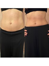 ゆう/１ヶ月未満でこの効果！