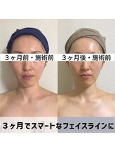 お顔の研究所/ビフォーアフター写真♪