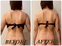 プリマ 栄店(Prima)/【2回施術】　BEFORE＆AFTER