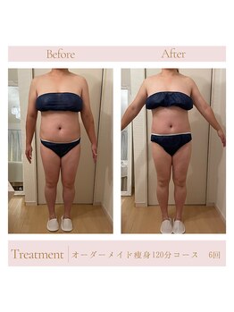 エミル(Emillu)/＊Body_ビフォーアフター