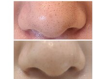 ビハダ(BeHADA)/#毛穴ゼロ#赤みゼロ