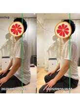 グレフル鍼灸接骨院 整体院 心斎橋/整体/肩こり/マッサージ/腰痛