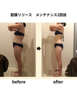 クリア(Clear)/筋膜リリース