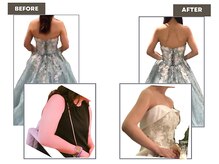 ビューティースリム リボーン 銀座店(reborn)/ブライダル 二の腕 背中集中ケア