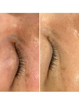 骨盤ダイエットサロン カンフリエ(camphrier)/シミケア【リシルク】