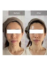 ココシア(cococia)/WISHProだけの変化です