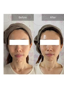 ココシア(cococia)/WISHProだけの変化です