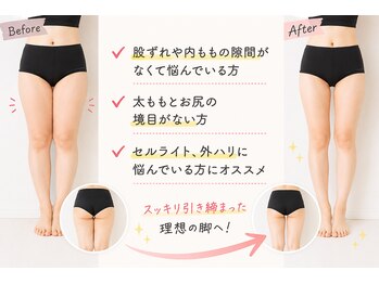 キートス(Kiitos)の写真/膝上のたるみ・股ずれ・外張り・お尻の境目・内ももの隙間が欲しい方やお悩み改善に自信あり♪