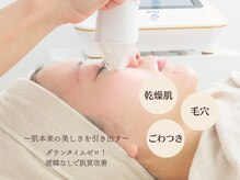エラ(Ella)
