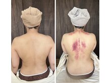 リュクス(Luxe)/ビフォーアフター（40代）