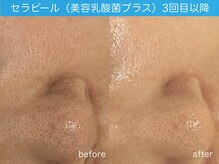 クレスト(CLEST.)/ララピールに美肌乳酸菌がプラス