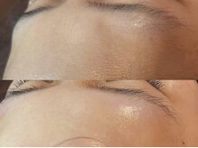 ラニブロウ(Lani brow)/化粧ノリが劇的アップ！