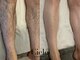 シエロ 町田店(Cielo)の写真/【リピーター続出★】Cieloのメンズ脱毛で毎日の髭剃りから解放されるチャンス！シュガーリング脱毛◎