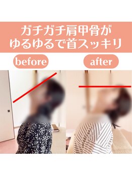 整体天使のはね 福山店/ガチガチ肩甲骨がゆるゆるに♪