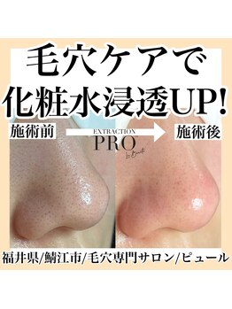 ピュール 鯖江店(PUR)/毛穴サロン/毛穴ケア/毛穴洗浄