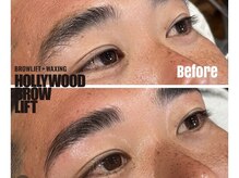 ハリウッドブロウリフト