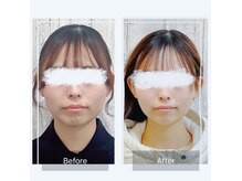 リリーガーデン 手稲店(Lily Garden)の雰囲気（【小顔若見え】韓国コルギで肩こりやむくみにも効果◎初回￥5000）