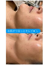 ムク(MUKU 無垢)/セラピール/40代のお客様