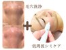 【毛穴＋シミ】 韓国式３D毛穴洗浄＋低周波シミケア30分　　 &nbsp;&nbsp;&nbsp;&nbsp;&nbsp;合計 120分