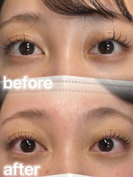 アイモア 吉祥寺店(eye mor.)/まつげパーマ/美眉/アイブロウ