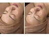 【大人気】美眉スタイリング＋フルフェイスwax脱毛(パック付）¥11000→¥7700