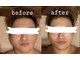 アーラ アンド べレア(ALA & Bellea)の写真/【メンズにオススメのサロン】
仕事疲れや顔のむくみが気になる男性へ徹底アプローチ!スッキリモテ顔へ