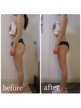 加圧ビューティーサロン スタイル エム(beauty salon style M)/20代/加圧×パワーツリー120分