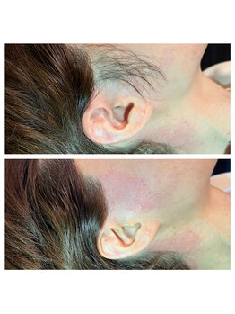 エムユー(Mu)/もみあげ整えて女性らしさUP!