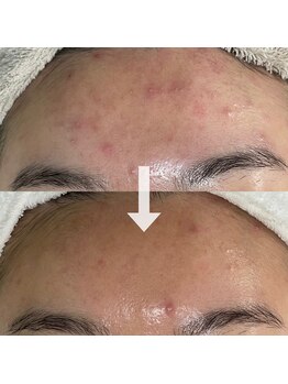 シェノン 赤坂大濠店/