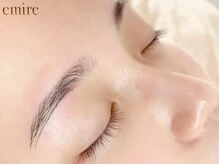 エミレ(emire)/大人気フェイシャルワックス脱毛