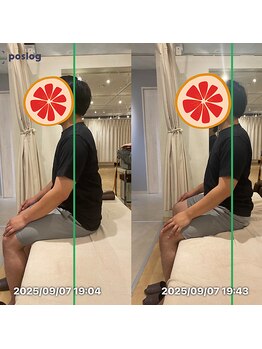 グレフル鍼灸接骨院 整体院 心斎橋/整体/肩こり/マッサージ/腰痛