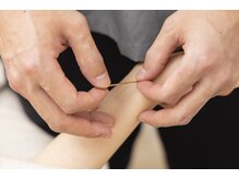 マッサージ鍼灸院つゆき按腹堂/刺さない鍼もございます。