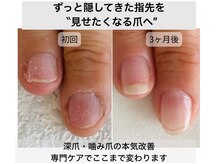 シーネイル(C Nail)