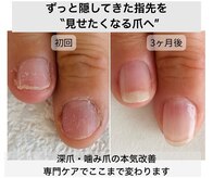 シーネイル(C Nail)