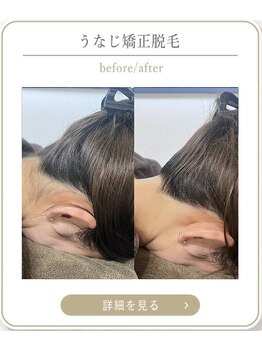 ミース 上野店/施術の流れと効果♪