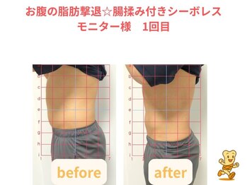 こつこつ接骨院 東麻布 赤羽橋の写真/便通の改善、お腹の張りがお悩みの方におすすめな腸揉みプラン!理想のくびれを手に入れましょう。